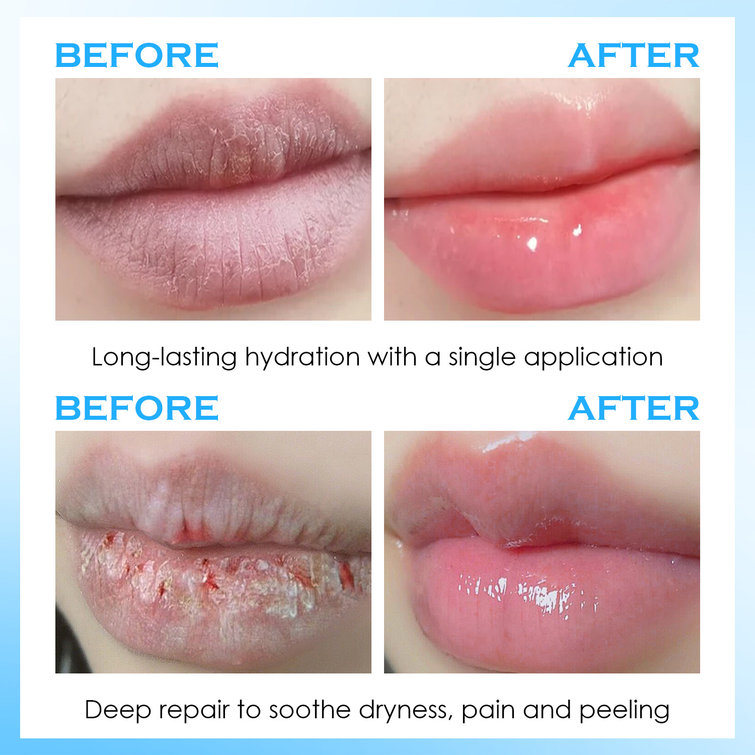 Lip Serum Moisturizing Balm Hy - đánh giá và giá Lip Balm