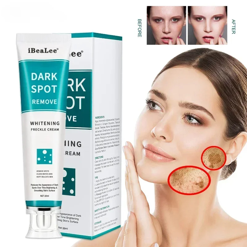 Whitening Freckle Cream Remove - đánh giá và giá Skincare Glowing