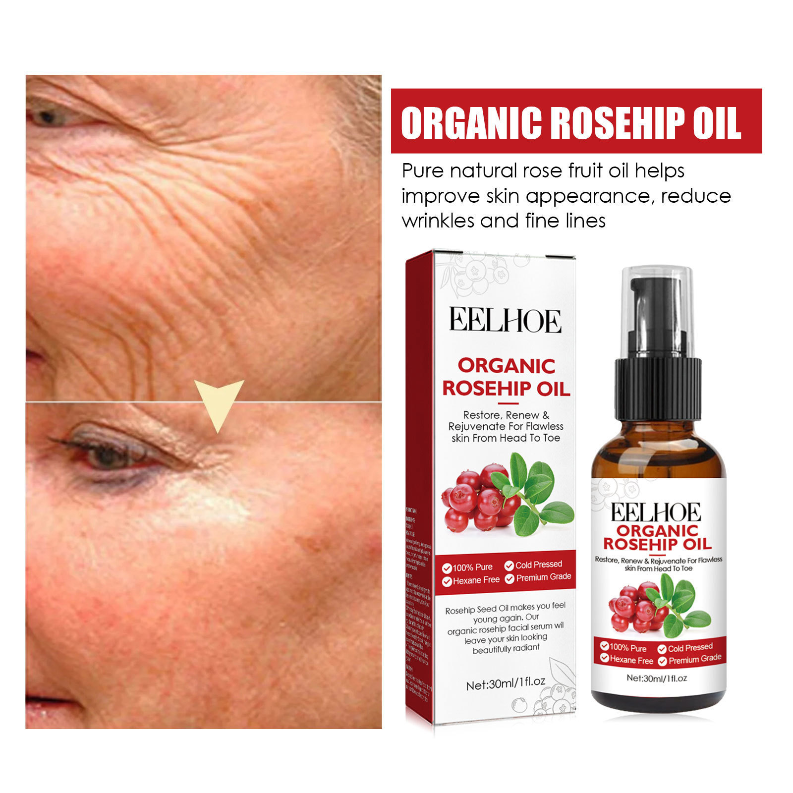 30ml Rosehip Oil Facial Serum  - đánh giá và giá Face Oil Rosehip